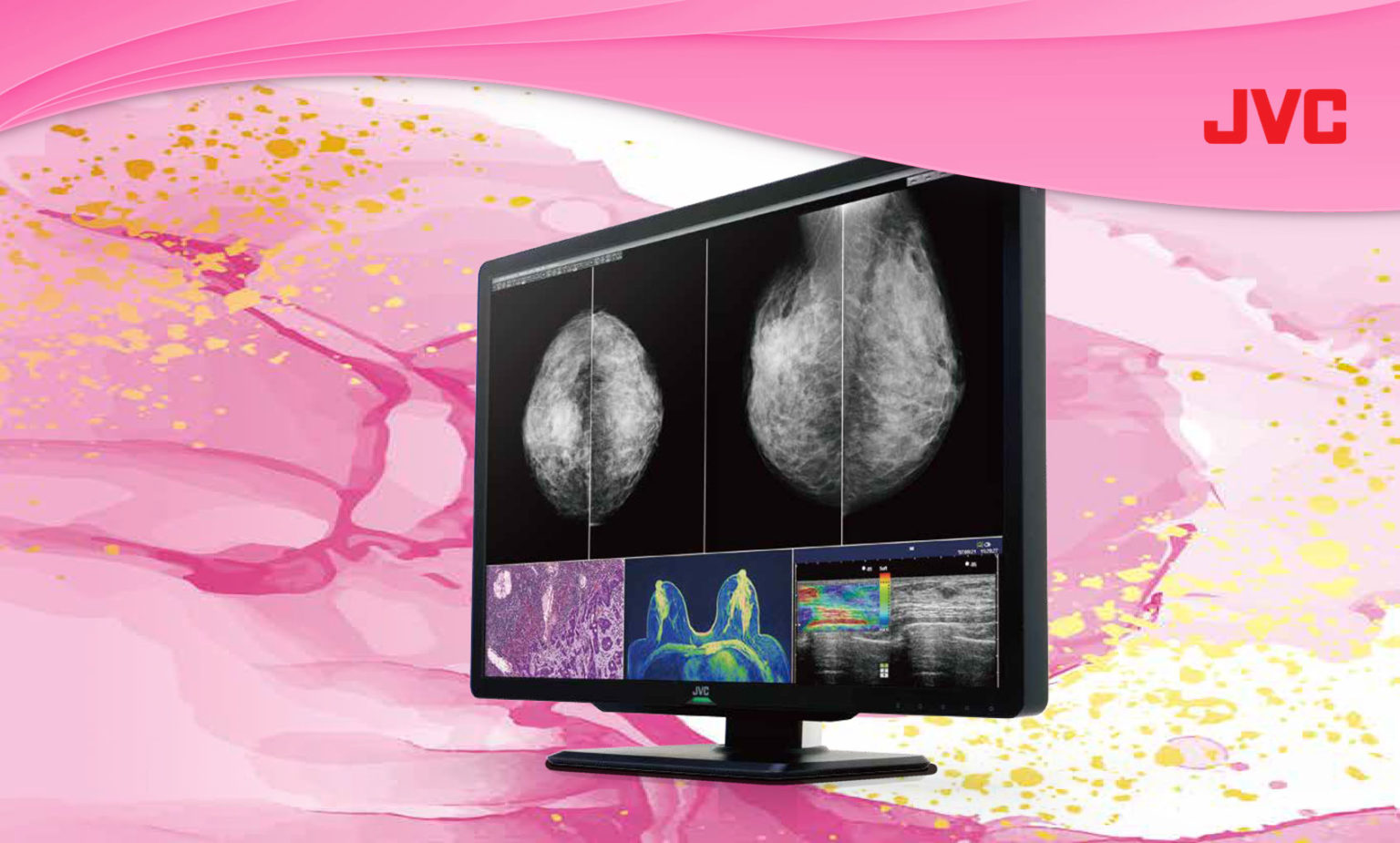 Alpha Imaging doo – Tehnologija u službi medicine